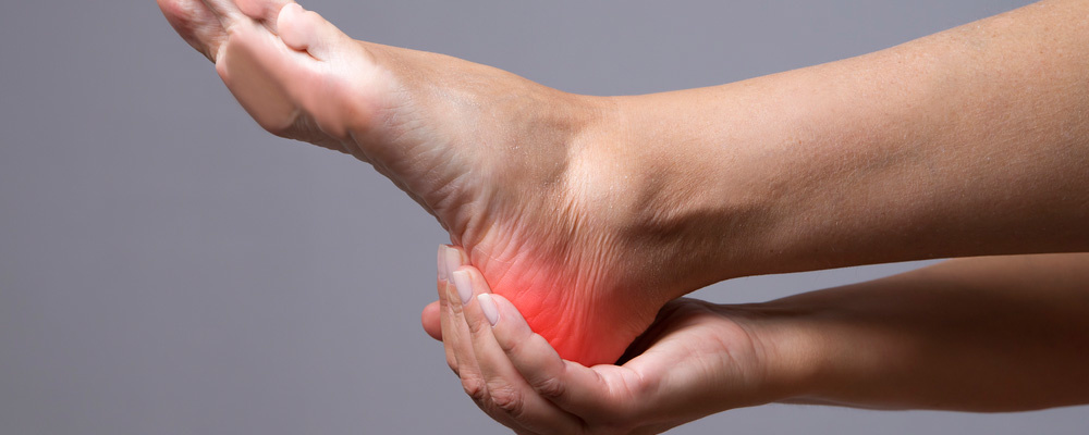 Plantar fasciitis and how to treat it