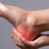 Plantar fasciitis and how to treat it